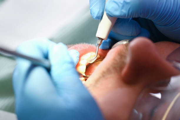 Best Orthodontic Emergency Dentist in Harwood Heights, IL