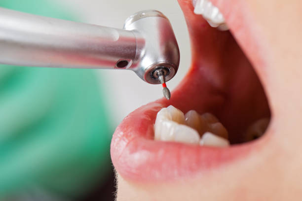Best Mobile Emergency Dentist in Harwood Heights, IL